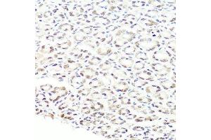 Immunohistochemistry of paraffin-embedded mouse stomach using PRPF8 antibody. (PRPF8 antibody  (AA 1-100))
