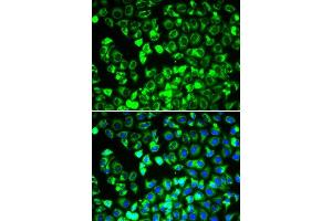 Immunofluorescence analysis of HeLa cells using DLD antibody.