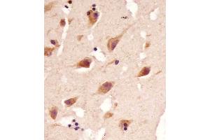 Immunohistochemistry (Paraffin-embedded Sections) (IHC (p)) image for anti-TANK-Binding Kinase 1 (TBK1) (AA 150-181) antibody (ABIN392371)