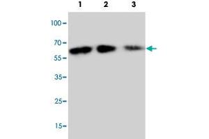 Western blot analysis of rbinate mouse Cx3cl1 protein with Cx3cl1 polyclonal antibody .