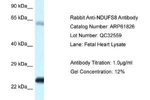 Western Blotting (WB) image for anti-NADH Dehydrogenase (Ubiquinone) Fe-S Protein 8, 23kDa (NADH-Coenzyme Q Reductase) (NDUFS8) (C-Term) antibody (ABIN2788918) (NDUFS8 antibody  (C-Term))