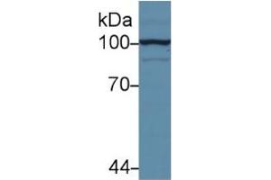 Rabbit Capture antibody from the kit in WB with Positive Control: Sample Human hela cell lysate. (Hexokinase 2 ELISA Kit)