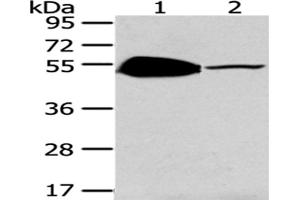 Western Blotting (WB) image for anti-TSPY-Like 1 (TSPYL1) antibody (ABIN5962132) (TSPYL1 antibody)