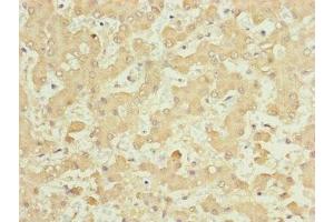 Immunohistochemistry of paraffin-embedded human liver tissue using ABIN7157665 at dilution of 1:100 (NUF2 antibody  (AA 165-464))