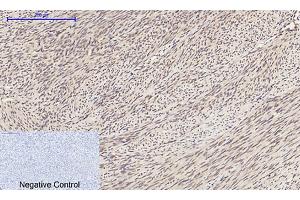 Immunohistochemical analysis of paraffin-embedded human uterus tissue. (ERK1/2 antibody  (AA 300-380))