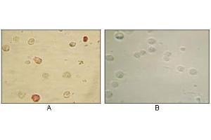 Immunocytochemistry analysis of TPA induced BCBL-1 cells (A) and uninduced BCBL-1 cells (B) using KSHV ORF45 mouse mAb with AEC staining. (KSHVORF45 antibody)