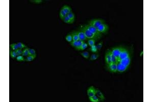 Immunofluorescent analysis of PC-3 cells using ABIN7155035 at dilution of 1:100 and Alexa Fluor 488-congugated AffiniPure Goat Anti-Rabbit IgG(H+L) (TIM3 antibody  (AA 22-202))