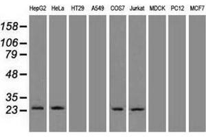 Western blot analysis of 35 µg of cell extracts from human brain tissue lysates using anti-NEUROG1 antibody. (Neurogenin 1 antibody)