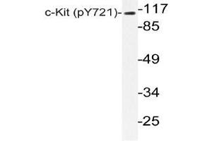Western blot (WB) analyzes of p-c-Kit (pTyr721) antibody in extracts from HepG2 EGF cells. (KIT antibody  (pTyr721))