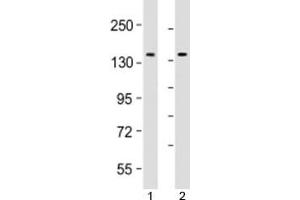 Western blot testing of human 1) Jurkat and 2) K562 cell lysate with TACC3 antibody at 1:2000. (TACC3 antibody  (AA 498-530))