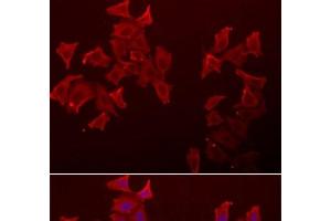 Immunofluorescence analysis of A549 cells using LECT1 Polyclonal Antibody