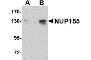 Western Blotting (WB) image for anti-Nucleoporin 155kDa (NUP155) (C-Term) antibody (ABIN1030553) (NUP155 antibody  (C-Term))