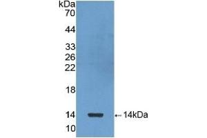 Detection of Recombinant bTG, Human using Polyclonal Antibody to Chemokine (C-X-C motif) ligand 7 ( CXCL7)