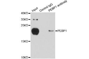 Immunoprecipitation analysis of 150ug extracts of MCF-7 cells using 3ug PEBP1 antibody. (PEBP1 antibody)