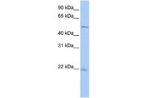 Western Blotting (WB) image for anti-Syndecan Binding Protein (Syntenin) 2 (SDCBP2) antibody (ABIN2459879) (SDCBP2 antibody)