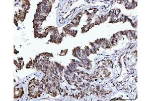 IHC analysis of USP26 using anti-USP26 antibody (ABIN7599543).