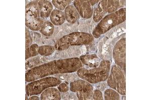 Immunohistochemical staining of human kidney with RNF7 polyclonal antibody  shows strong cytoplasmic positivity in cells in tubules at 1:20-1:50 dilution.