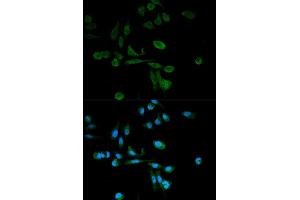Immunofluorescence analysis of HeLa cell using SIRT7 antibody. (SIRT7 antibody  (AA 201-400))