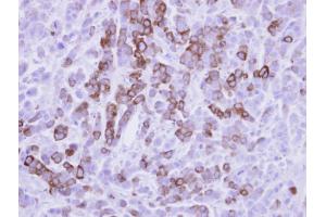 IHC-P Image Immunohistochemical analysis of paraffin-embedded MDA-MB-468 xenograft, using MX1, antibody at 1:500 dilution. (MX1 antibody  (Internal Region))