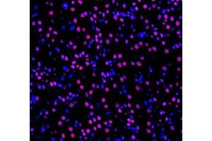 Immunofluorescence of paraffin embedded mouse kidney using GTF3C3 (ABIN7074039) at dilution of 1: 650 (400x lens) (GTF3C3 antibody)