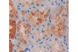 #VALUE! (MAP3K7CL antibody  (AA 1-242))