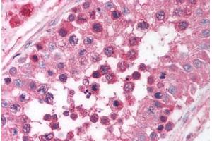 Human Testis (formalin-fixed, paraffin-embedded) stained with EGR4 antibody ABIN214101 at 5 ug/ml followed by biotinylated goat anti-rabbit IgG secondary antibody ABIN481713, alkaline phosphatase-streptavidin and chromogen. (EGR4 antibody  (C-Term))