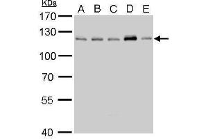 WB Image CYLD antibody detects CYLD protein by Western blot analysis. (CYLD antibody  (C-Term))