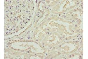 Immunohistochemistry of paraffin-embedded human kidney tissue using ABIN7146153 at dilution of 1:100 (C1GALT1C1 antibody  (AA 30-190))