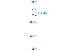 Doublecortin Protein (DCX) (AA 1-360) (GST tag)