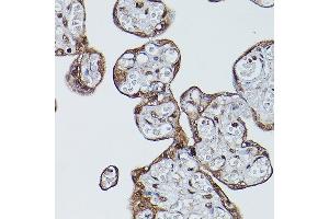 Immunohistochemistry of paraffin-embedded human placenta using BSG Rabbit pAb (ABIN3022146, ABIN3022147, ABIN1512647 and ABIN6218629) at dilution of 1:100 (40x lens). (CD147 antibody  (AA 30-200))