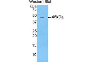 Western blot analysis of the recombinant protein. (Lipocalin 4 (LCN4) (AA 20-178) antibody)