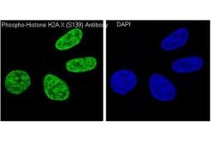 Immunofluorescent staining of human HeLa cells treated and untreated with H2O2 using phospho-Histone H2AX antibody (green) and DAPI nuclear stain (blue). (H2AFX antibody  (pSer139))