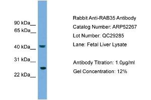 WB Suggested Anti-RAB35  Antibody Titration: 0. (RAB35 antibody  (Middle Region))