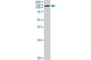 Western Blotting (WB) image for anti-ATP-Binding Cassette, Sub-Family F (GCN20), Member 1 (ABCF1) (AA 1-845) antibody (ABIN513036)