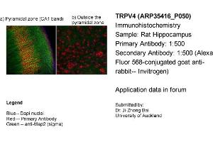Immunohistochemistry (IHC) image for anti-Transient Receptor Potential Cation Channel, Subfamily V, Member 4 (TRPV4) (Middle Region) antibody (ABIN2776284) (TRPV4 antibody  (Middle Region))