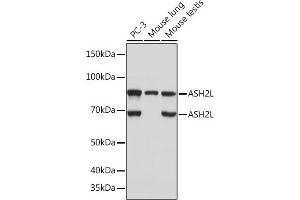 anti-Set1/Ash2 Histone Methyltransferase Complex Subunit ASH2 (ASH2L) antibody