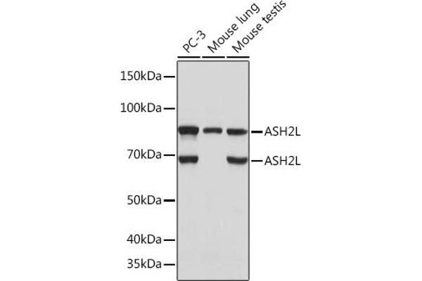 ASH2L anticorps