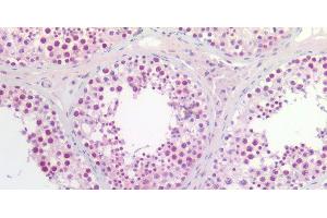 Immunohistochemistry of paraffin-embedded Human testis using CCNL2 Polyclonal Antibody at dilution of 1:200. (Cyclin L2 antibody)
