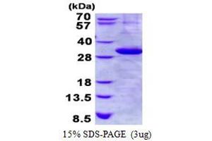 Kallikrein 1 (KLK1) (AA 25-262) protein (His tag)