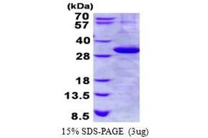 Image no. 1 for Kallikrein 1 (KLK1) protein (His tag) (ABIN6387054) (Kallikrein 1 Protein (KLK1) (His tag))