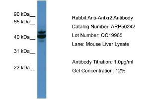 WB Suggested Anti-Antxr2  Antibody Titration: 0. (ANTXR2 antibody  (N-Term))