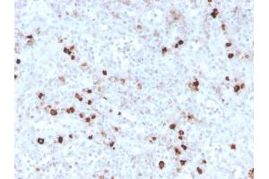 Formalin-fixed, paraffin-embedded human spleen stained with IgM Recombinant Rabbit Monoclonal Antibody (IGHM/3776R). (Recombinant IGHM antibody)