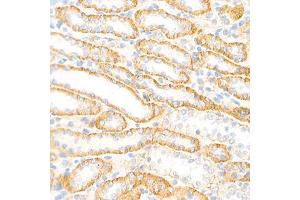 Immunohistochemistry analysis of paraffin-embedded rat kidney using,Cadherin 16 (ABIN7073265) at dilution of 1: 2000 (Cadherin-16 antibody)