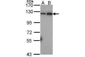 Western Blotting (WB) image for anti-Nuclear Factor of kappa Light Polypeptide Gene Enhancer in B-Cells 2 (NFKB2) (C-Term) antibody (ABIN2854310)