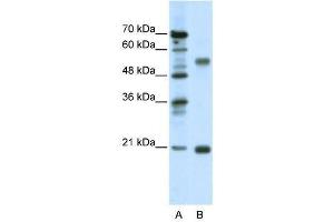 Western Blot showing CHRNB3 antibody used at a concentration of 1-2 ug/ml to detect its target protein. (CHRNB3 antibody  (Middle Region))