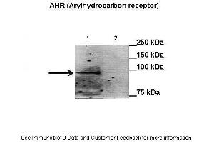 Lanes:   Lane1: 50 ug HepG2 nuclei extract + benzo[a]pyrene Lane2: 50 ug HepG2 cytoplasm extract + benzo[a]pyrene  Primary Antibody Dilution:   1:1000  Secondary Antibody:   Anti-rabbit HRP  Secondary Antibody Dilution:   1:1000  Gene Name:   AHR (Arylhydrocarbon receptor)  Submitted by:   Anonymous (Aryl Hydrocarbon Receptor antibody  (N-Term))