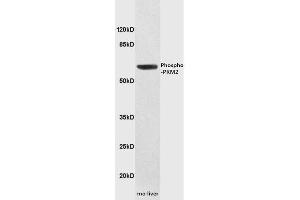 Protein: mouse liver lysates, 30ug; Primary: Anti-Phospho-PKM2(Tyr105)  at 1: 5000; ECL excitated the fluorescence; Predicted band size : 58kD Observed band size : 58kD (PKM2 antibody  (pTyr105))