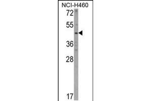 Western blot analysis of KYNU Antibody in NCI-H460 cell line lysates (35ug/lane)