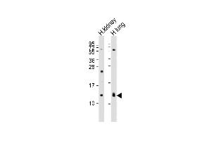 All lanes : Anti-REG3G Antibody (Center) at 1:2000 dilution Lane 1: human kidney lysates Lane 2: human lung lysates Lysates/proteins at 20 μg per lane. (REG3g antibody  (AA 89-116))