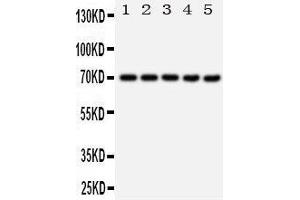 Western Blotting (WB) image for anti-Heat Shock 70kDa Protein 1A (HSPA1A) (AA 577-596), (C-Term) antibody (ABIN3044190)
